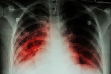 Public Health Fakes: A tuberculosis epidemic is spreading in Ukraine, and due to the medical reform, all anti-tuberculosis dispensaries were closed. Issue #22
