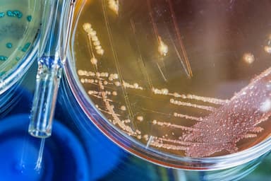 Public Health Fakes: cholera outbreak in Kyiv and the epidemic of tuberculosis in Zaporizhzhia. Issue #34