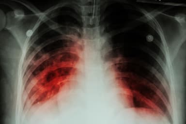 Фейки щодо системи охорони здоров’я: Україну накриває епідемія туберкульозу, а всі тубдиспансери закрили через медреформу. Випуск №22